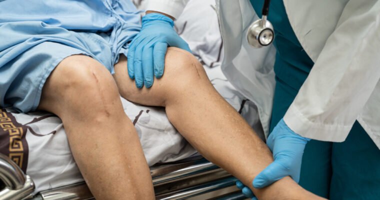 What Actually Makes Knee Surgery Recovery Go Smoothly